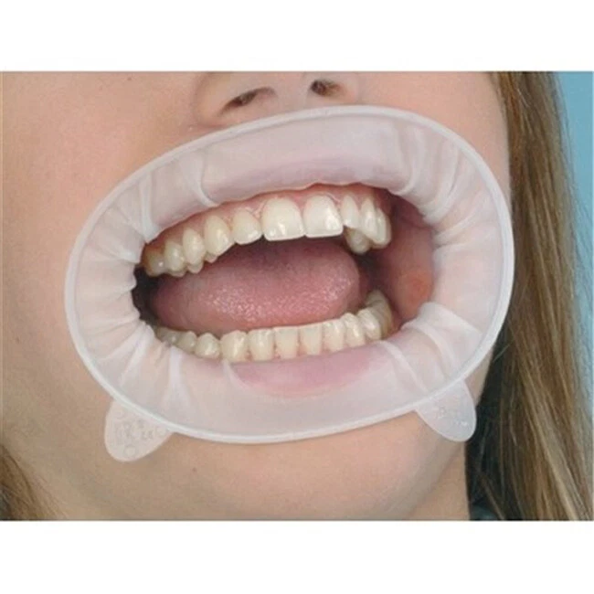 VENEER CHEEK RETRACTOR